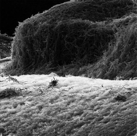 Heliumionimikroskoopilla Nanotiedekeskuksessa kuvattua bakteerikasvustoa.