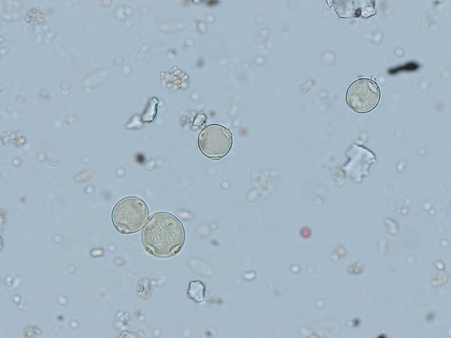Koivun siitepölyhiukkasia mikroskoopin läpi nähtynä.
